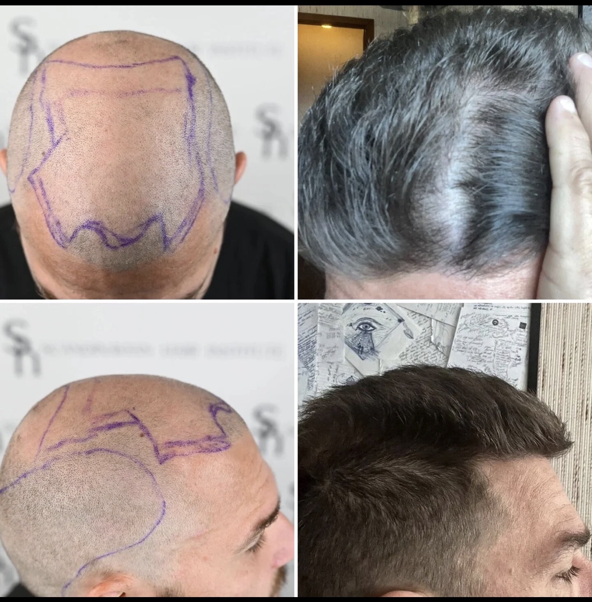 Before and after