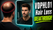 VDPHL01: THIS Hair Loss Pill That Will STOP Hair Loss!